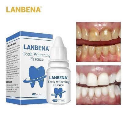 برند لانبنا محصول کدام کشور است سفید کننده دندان :